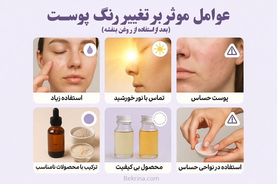 عوامل موثر بر تغییر رنگ پوست بعد روغن بنفشه